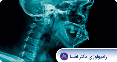 Cover_Image