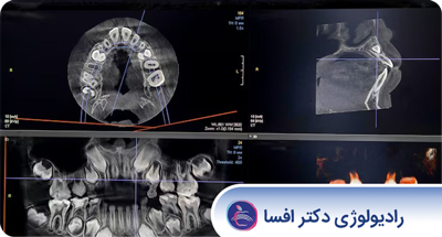 Cover_Image